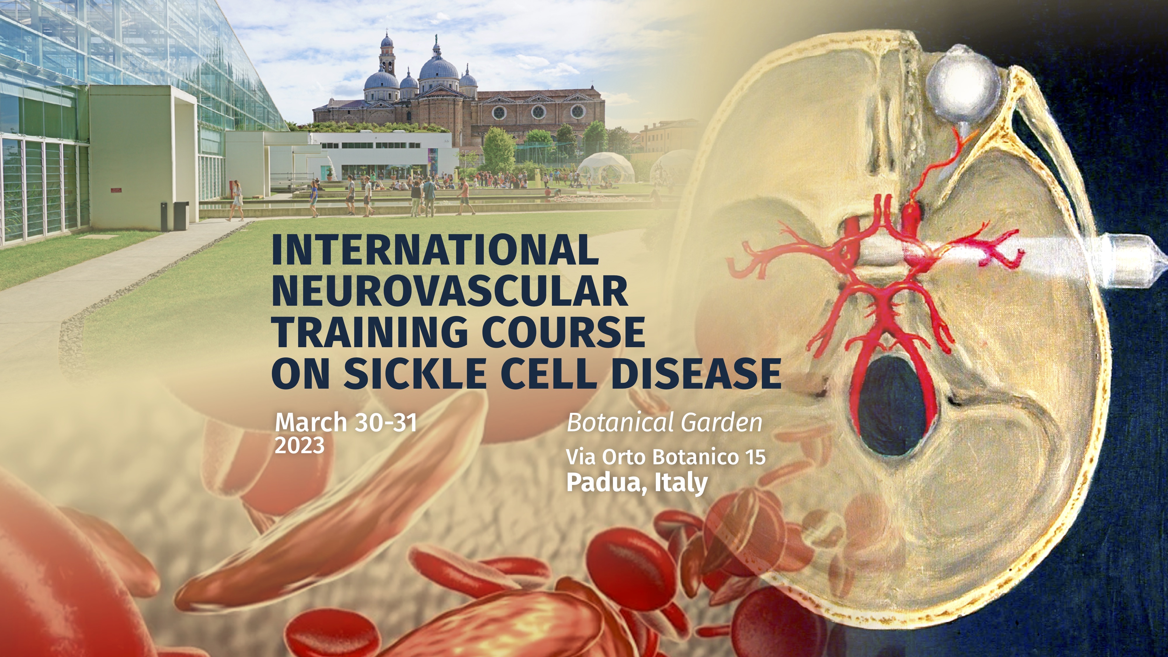 International neurovascular training course on sickle cell disease
